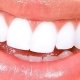 Cómo enumeran los dientes los dentistas